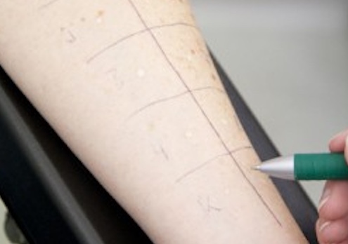 Dies ist ein Symbolbild für Lungenheilkunde der Lungenpraxis Senden.